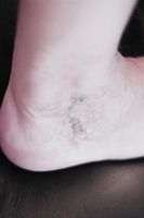 болки в краката - 79870 възможности болки в краката - 78863 възможности