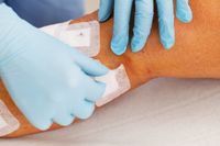 болки в краката - 36452 типа болки в краката - 82042 типа