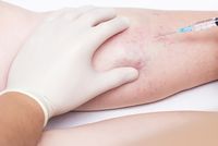 болки в краката - 51052 снимки болки в краката - 90844 снимки