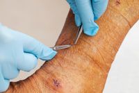 болки в краката - 37049 селекции болки в краката - 66291 селекции