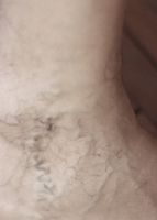 болки в краката - 79228 новини болки в краката - 99149 новини