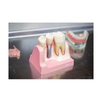 коронки - 47163 разновидности | Dental Club коронки - 53890 разновидности