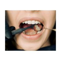 мезотерапия Варна - 61484 варианти