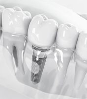 ретиниран мъдрец - 46096 вида