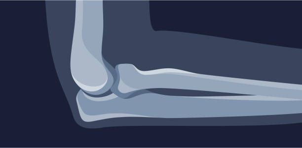 костна плътност - 70616 снимки